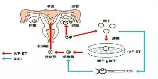 兰州捐卵